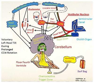 The Neurovestibular Challenges of Astronauts and Balance Patients: Some Past Countermeasures and Two Alternative Approaches to Elicitation, Assessment and Mitigation